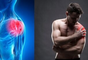 left shoulder pain icd 10