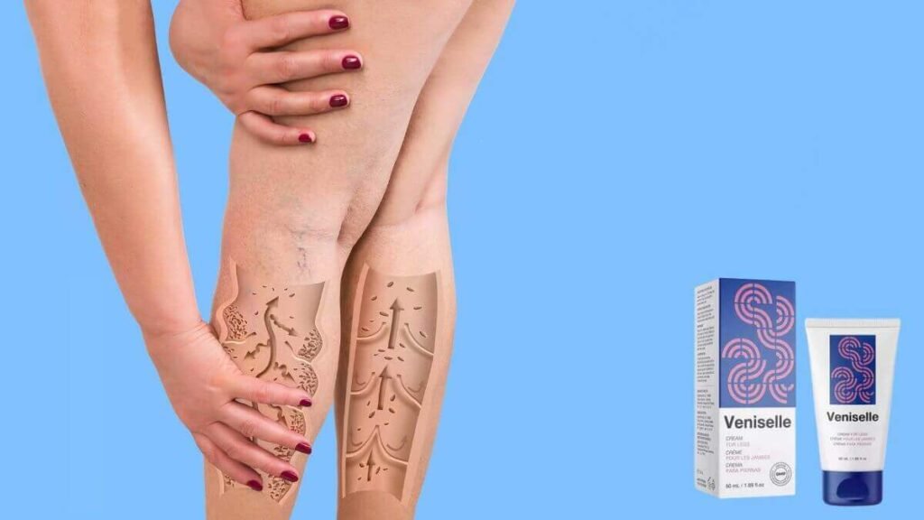varicose vein removal cos
