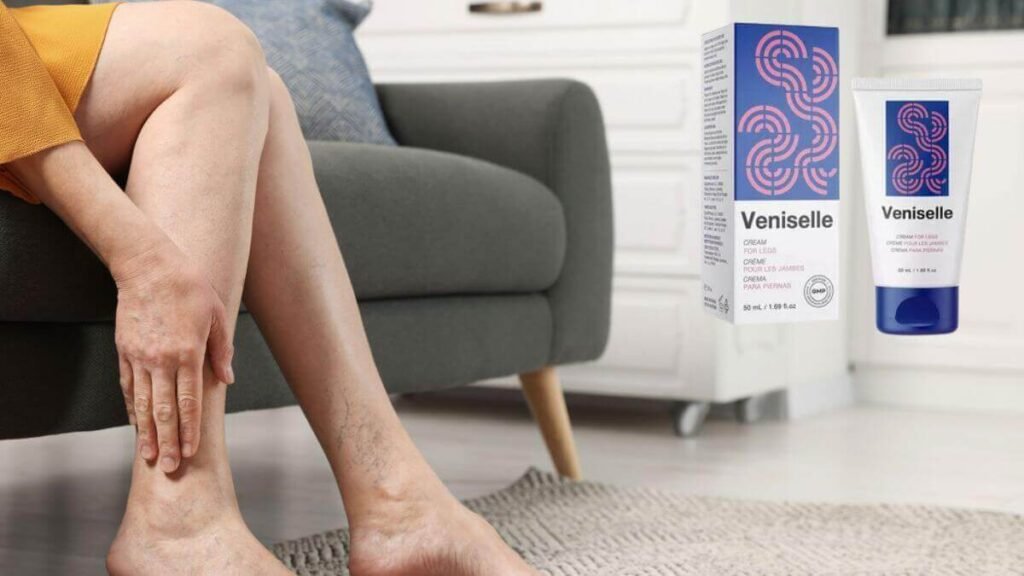 varicose veins cream