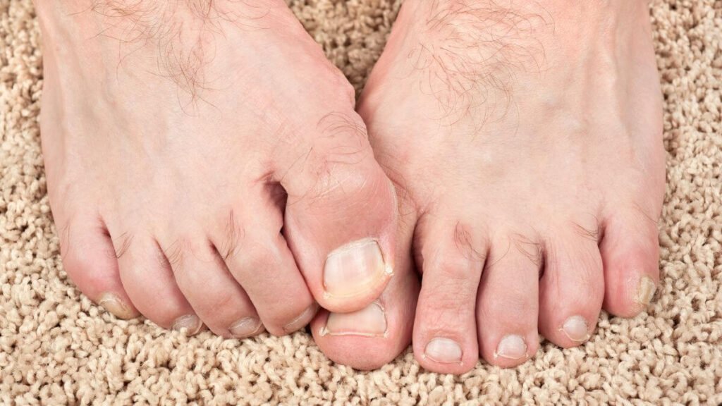 How to Relieve Itchy Feet at Night 3
