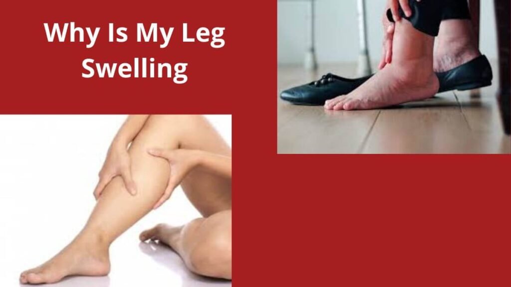 Why is my left leg swelling