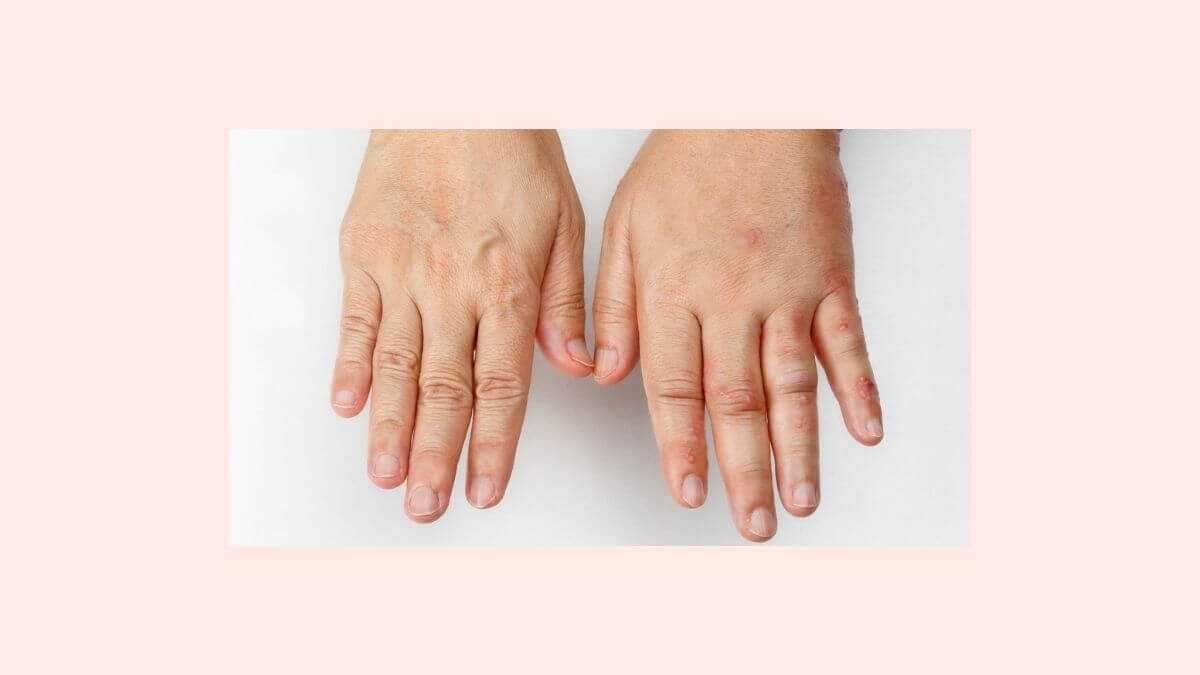 why do my hands swell when i walk