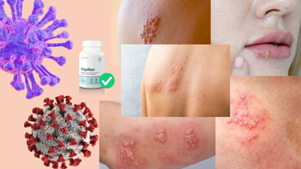 Herpes Virus vs HPV 1