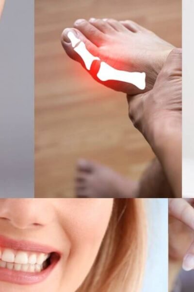 Does Icy Hot Reduce Inflammation