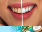 does coconut oil whiten teeth 6