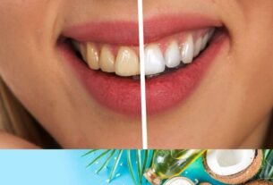 does coconut oil whiten teeth 6