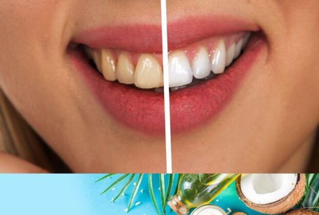 does coconut oil whiten teeth 6
